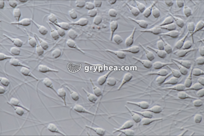 Spermatozoïdes de la Moule (Mytilus edulis) x400 - gryphea.org